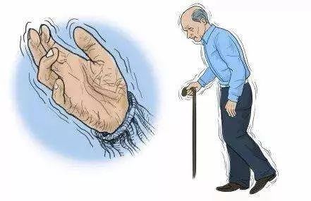 帕金森病的誤區(qū)，你知道嗎？
