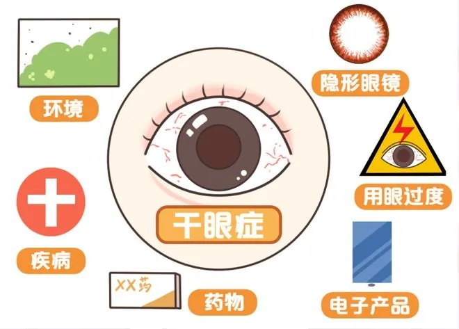干眼癥是“絕癥”嗎？
