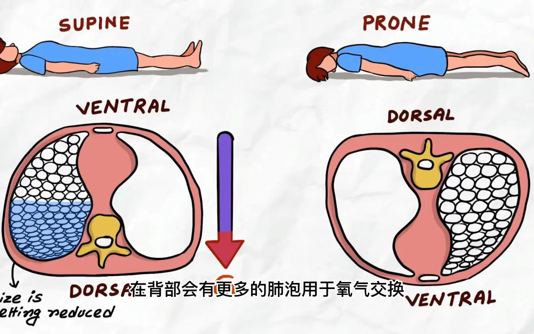 換個姿勢睡覺，竟然可以救命